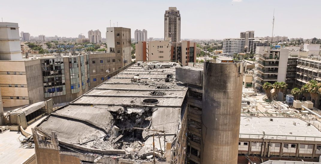 הדמיה של שיקום סורוקה